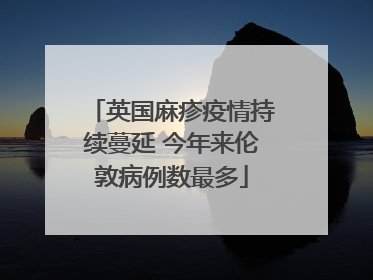 英国麻疹疫情持续蔓延 今年来伦敦病例数最多